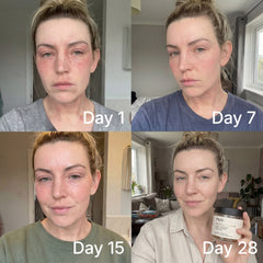 Clear Skin + Gut Harmony Gummies™