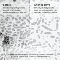 Clear Skin + Gut Harmony Gummies™