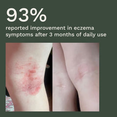 Clear Skin + Gut Harmony Gummies™