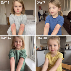 Clear Skin + Gut Harmony Gummies™